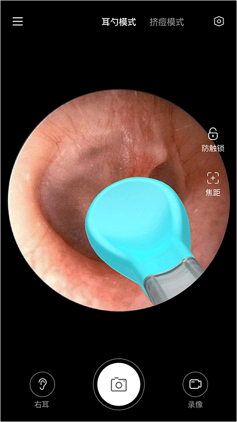 Xlife掏耳勺免费版