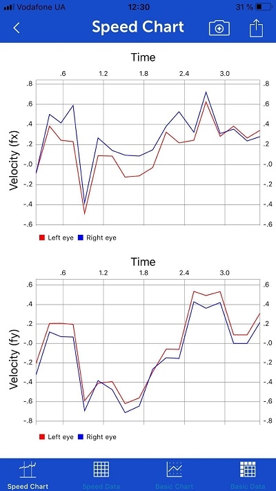 手机眼动追踪EyeTracker